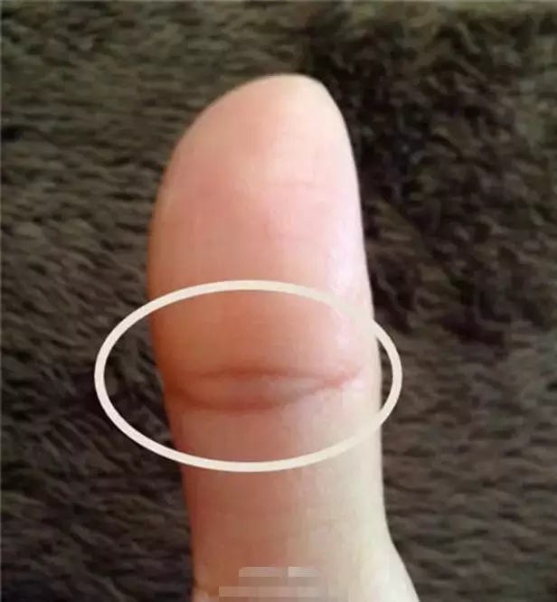 手掌纹的一种,位于大拇指第二节手掌虎口处的横指节纹呈几个眼状纹